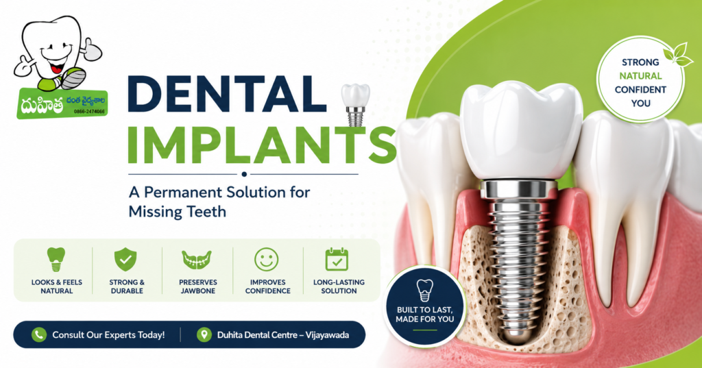 Dental Implants in Vijayawada