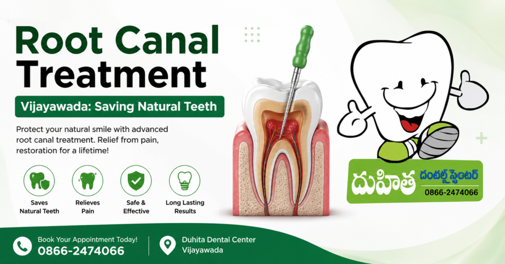 Root Canal Treatment